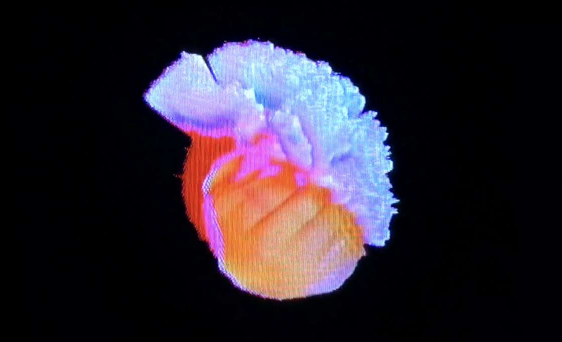 Artwork: Naegleria Fowleri